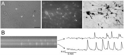 Vasoactive intestinal peptide excites GnRH neurons via KCa3.1, a potential player in the slow afterhyperpolarization current